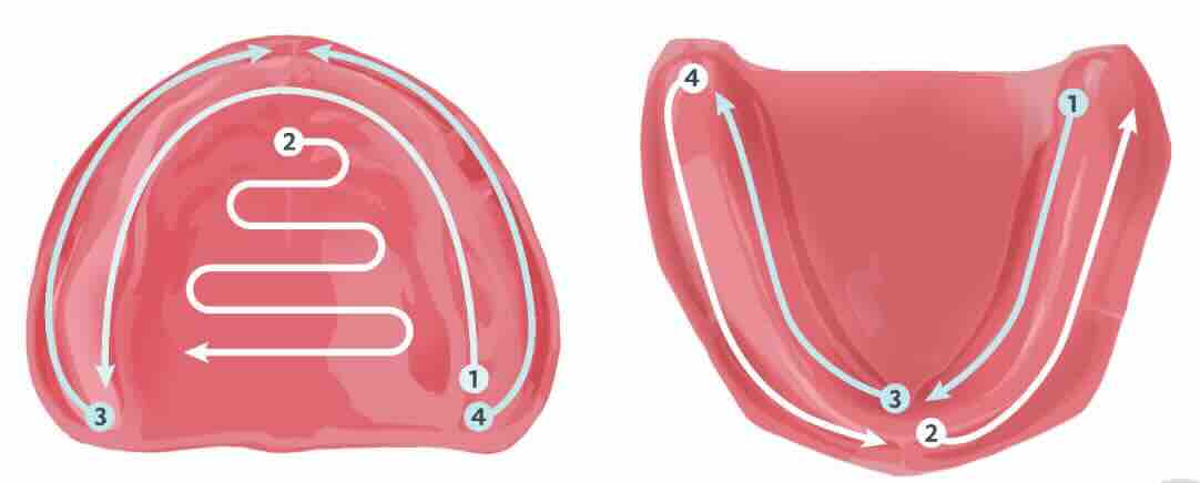Intraoral scanning strategy of edentulous maxilla and mandible with segmented acquisition path to improve stitching accuracy and control
