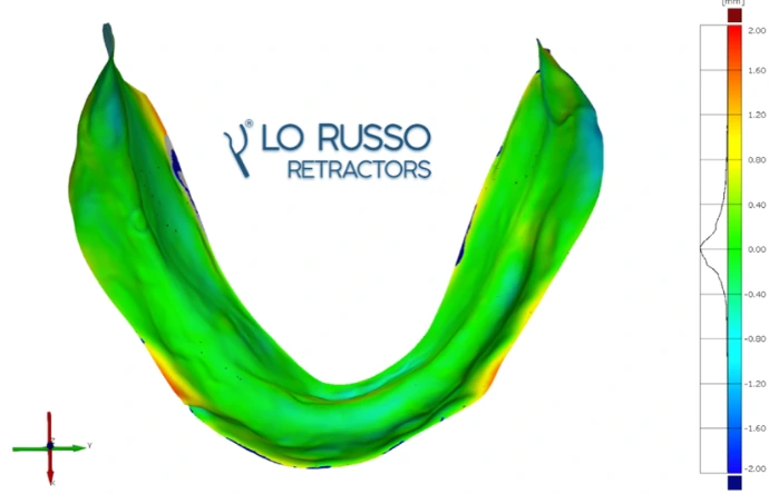 Dettaglio di scansione full arch per valutazione dell’accuratezza digitale