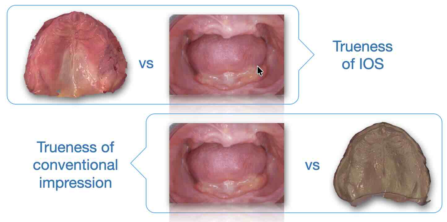 intraoral scan vs conventional impression edentulous arch what should be compared to define trueness