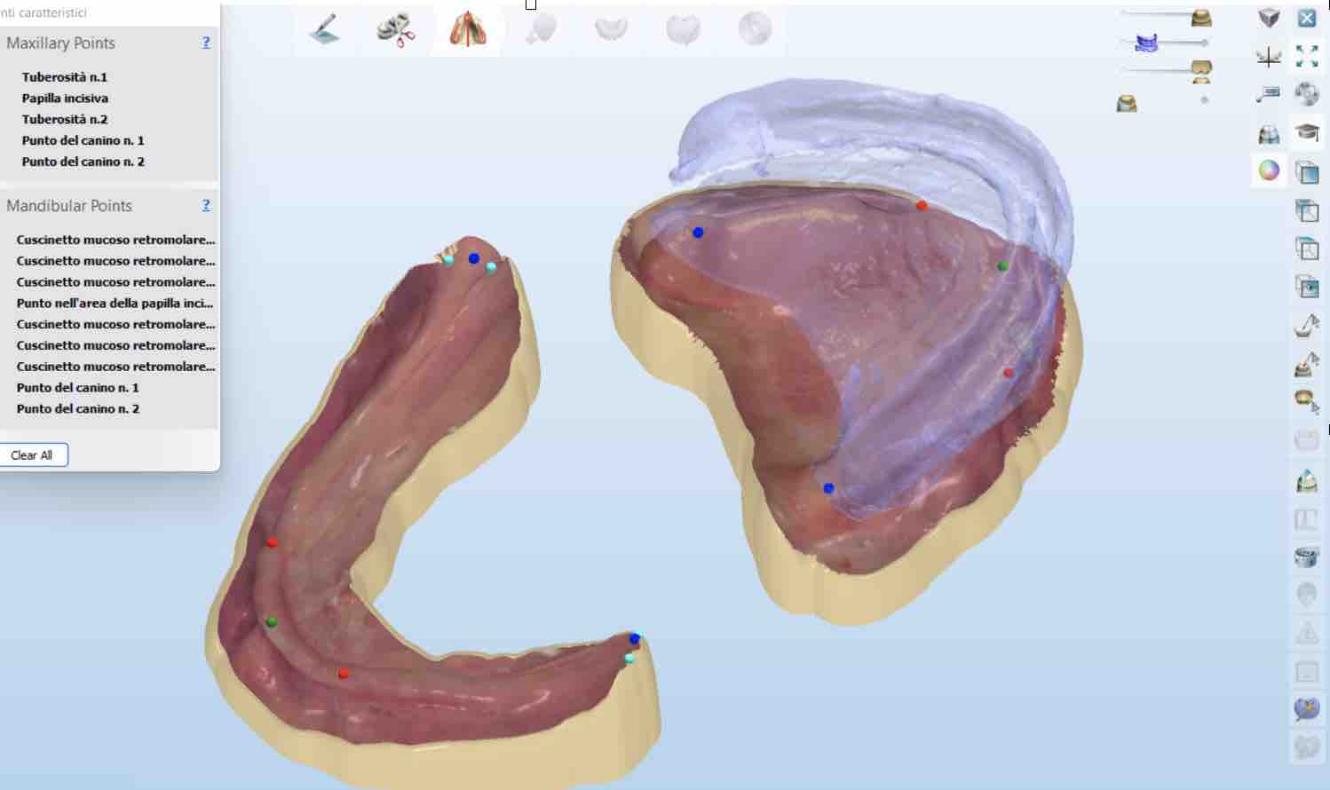 intraoral scan for removable complete double arch denture