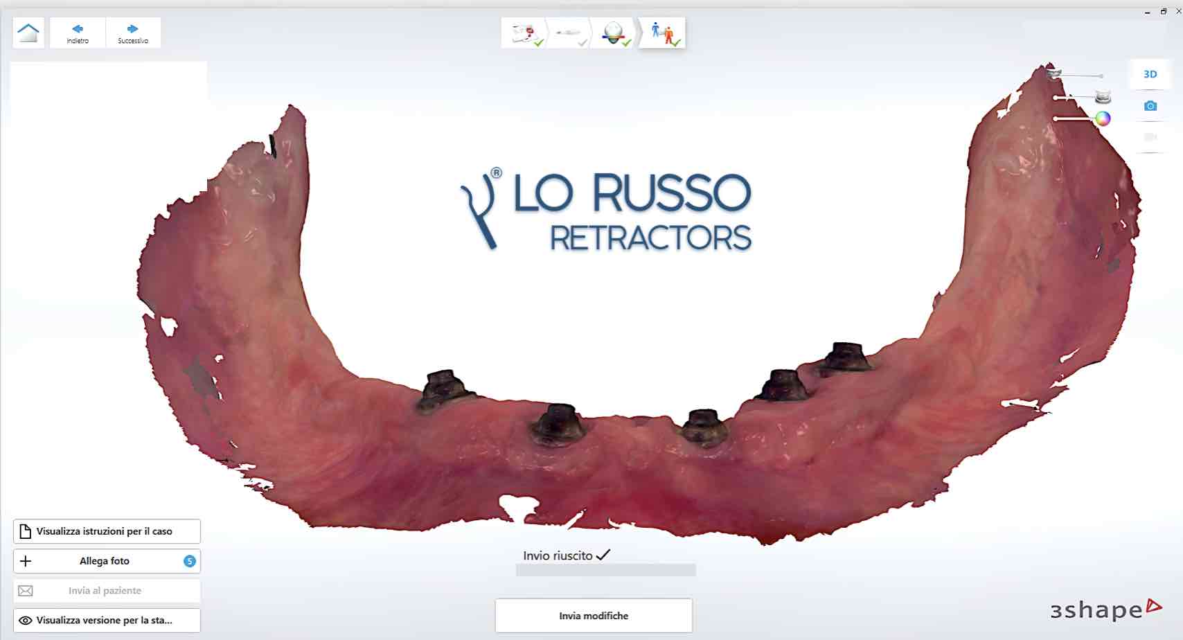 Intraoral scanning of edentulous arches lorussoretractors