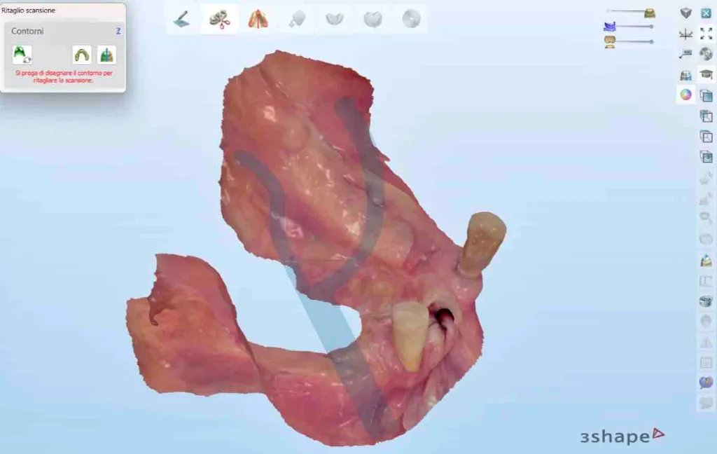 partial ed2 copia.webp