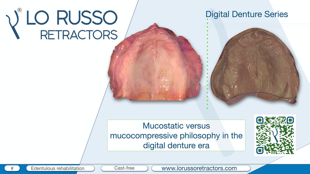Filosofía mucostática (escaneado intraoral) vs. mucocompresiva en la era de la prótesis total digital - [C24]