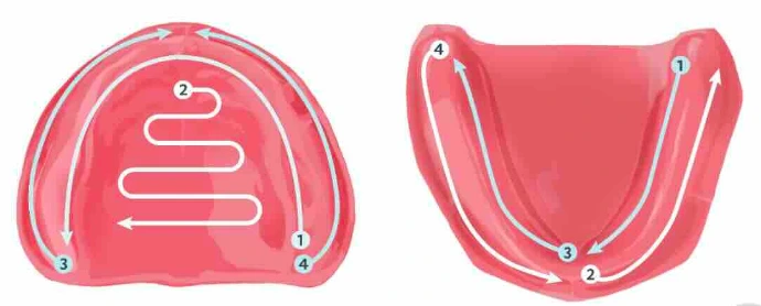 Intraoral scanning strategies for edentulous arches