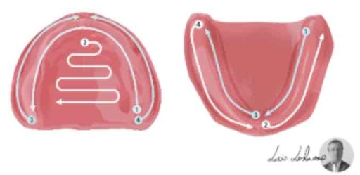 Intraoral scanning strategies for edentulous arches